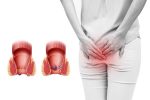 Trĩ nội là gì ? Phân độ và cách điều trị hiệu quả