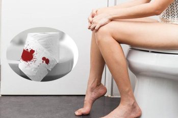 Đi đại tiện ra máu phải làm sao? Có nguy hiểm không?