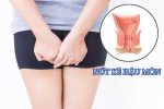 Nứt kẽ hậu môn có tự khỏi không ? Sự thật bạn cần biết