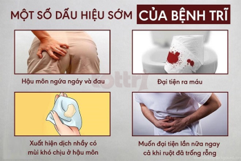 Ngại đi khám trĩ ? Đây là những điều bạn cần biết