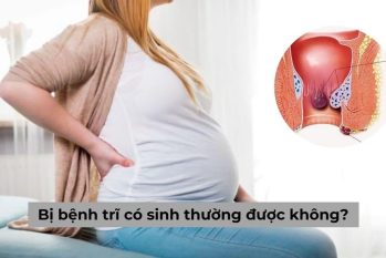 Bệnh trĩ có sinh thường được không ?