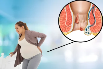 Bị bệnh trĩ có mang thai được không ?