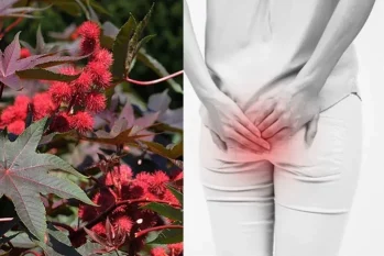 Chữa bệnh trĩ bằng cây thầu dầu tía có hiệu quả không ?